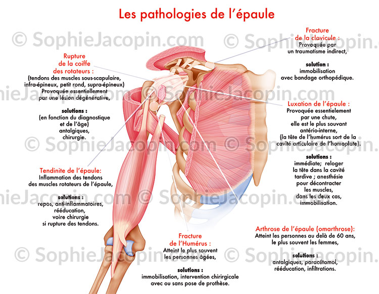 MUSCLE ÉPAULE – Image 5