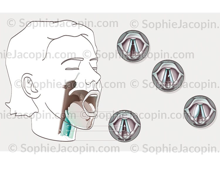 PATHOLOGIES CORDES VOCALES – Image 2