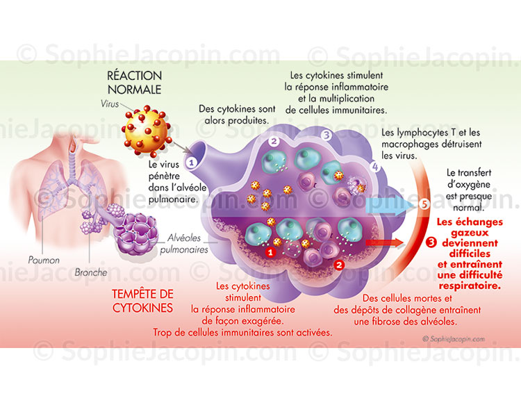 CYTOKINES ET RÉPONSE INFLAMMATOIRE – Image 3